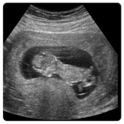 diagnostic imaging in torrance yelp