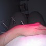 Photo of Nanjing Acupuncture Clinic