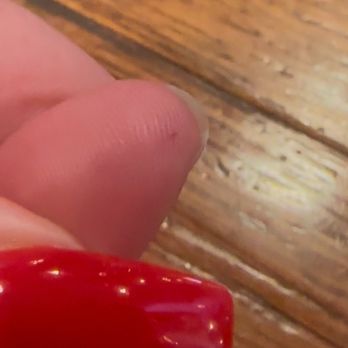 Wild Wing Cafe - My daughter's punctured finger - Chicken Wings Near Me - Greenville, South Carolina Wild Wing Cafe - My daughter's punctured finger - Chicken Wings Near Me - Greenville, South Carolina
