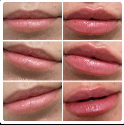 Redefine Your Natural Beauty! Call Today! - Call today to book your free consultation! 
We smooth fine lines, restore volume, and achieve a youthful glow. Our treatments restore texture, clarity and youthful glow. We can also help with fat reduction, hair restoration and wellness
injections.