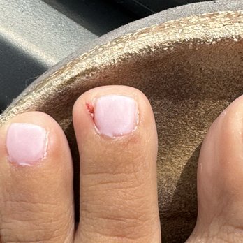 Royal Nails - Cut from nail trimmer, wouldn't stop bleeding - Nail Salons Near Me - Brownsville, Texas Royal Nails - Cut from nail trimmer, wouldn't stop bleeding - Nail Salons Near Me - Brownsville, Texas