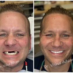 Elk Grove Smile Center: Vishal Advani, DDS