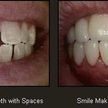 Cary N. Goldstein, DDS - Oral Surgeons Near Me - Wickliffe, Ohio