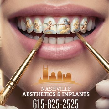 Nashville Aesthetics & Implants - Cosmetic Dentists Near Me - Nashville, Tennessee Nashville Aesthetics & Implants - Cosmetic Dentists Near Me - Nashville, Tennessee