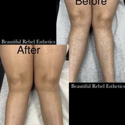 Beautiful Rebel Esthetics - Before & After Leg Wax