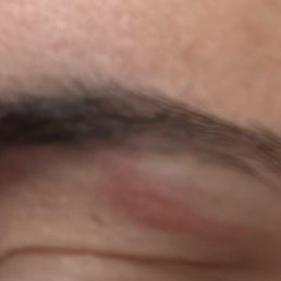 Burned from waxing at Diamond nail.