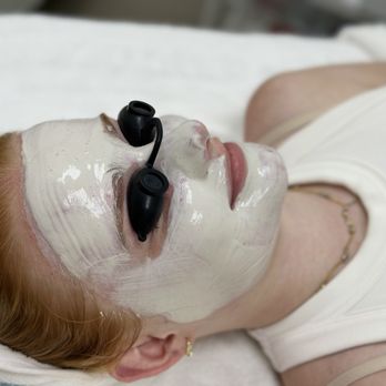 Lesan Esthetics - Clarifying/ detoxifying face mask - Acne Treatment Near Me - Naperville, Illinois