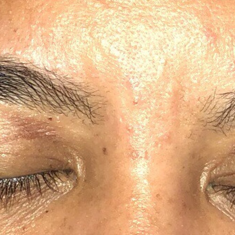 Coco Nail Spa - Ugly burns that hurt like a b**** 2 days later - Nail Salons Near Me - Eleele, Hawaii Coco Nail Spa - Ugly burns that hurt like a b**** 2 days later - Nail Salons Near Me - Eleele, Hawaii