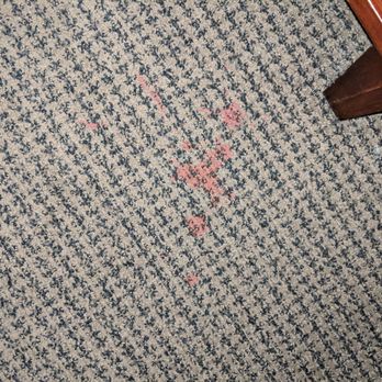 Embassy Suites by Hilton Buffalo - Stain on Left Side of Bed - Hotels Near Me - Buffalo, New York