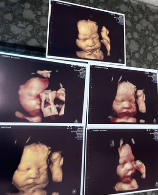 MOMMY AND ME 3D 4D ULTRASOUND - Updated July 2026 - 291 Photos & 580 ...