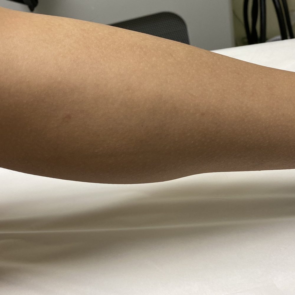 Bared Monkey Laser Spa - Hairless legs - Laser Hair Removal Near Me - New York, New York Bared Monkey Laser Spa - Hairless legs - Laser Hair Removal Near Me - New York, New York