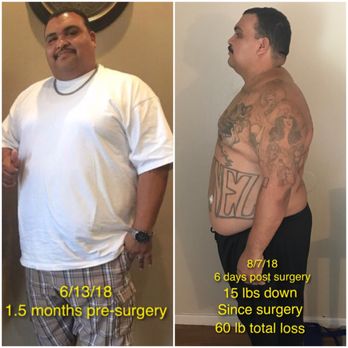 Eslami Afshin, MD - Slim life Solutions - Cosmetic Surgeons Near Me - Folsom, California Eslami Afshin, MD - Slim life Solutions - Cosmetic Surgeons Near Me - Folsom, California