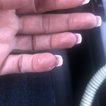 Ritz Nails - Glue and powder all over my fingers and this is after I asked her twice to clean it. - Nail Salons Near Me - Tustin, California Ritz Nails - Glue and powder all over my fingers and this is after I asked her twice to clean it. - Nail Salons Near Me - Tustin, California