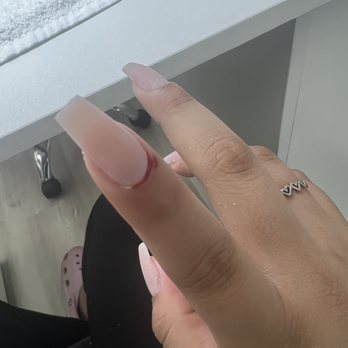 Apika Beauty Studio - My cuticle bleeding - Nail Salons Near Me - Greenacres, Florida Apika Beauty Studio - My cuticle bleeding - Nail Salons Near Me - Greenacres, Florida
