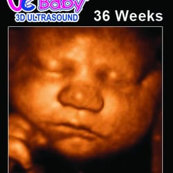 UC Baby - 3D Ultrasound