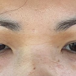 2301 Plastic Surgery - Before