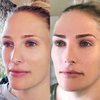 StudioLash - Before and after of Microblading. - Eyelash Service Near Me - Ventura, California StudioLash - Before and after of Microblading. - Eyelash Service Near Me - Ventura, California
