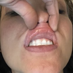 Skin and Cancer Institute - My lips
