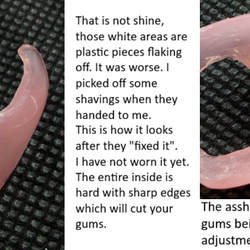 Haslam Dental - What you actually end up with.