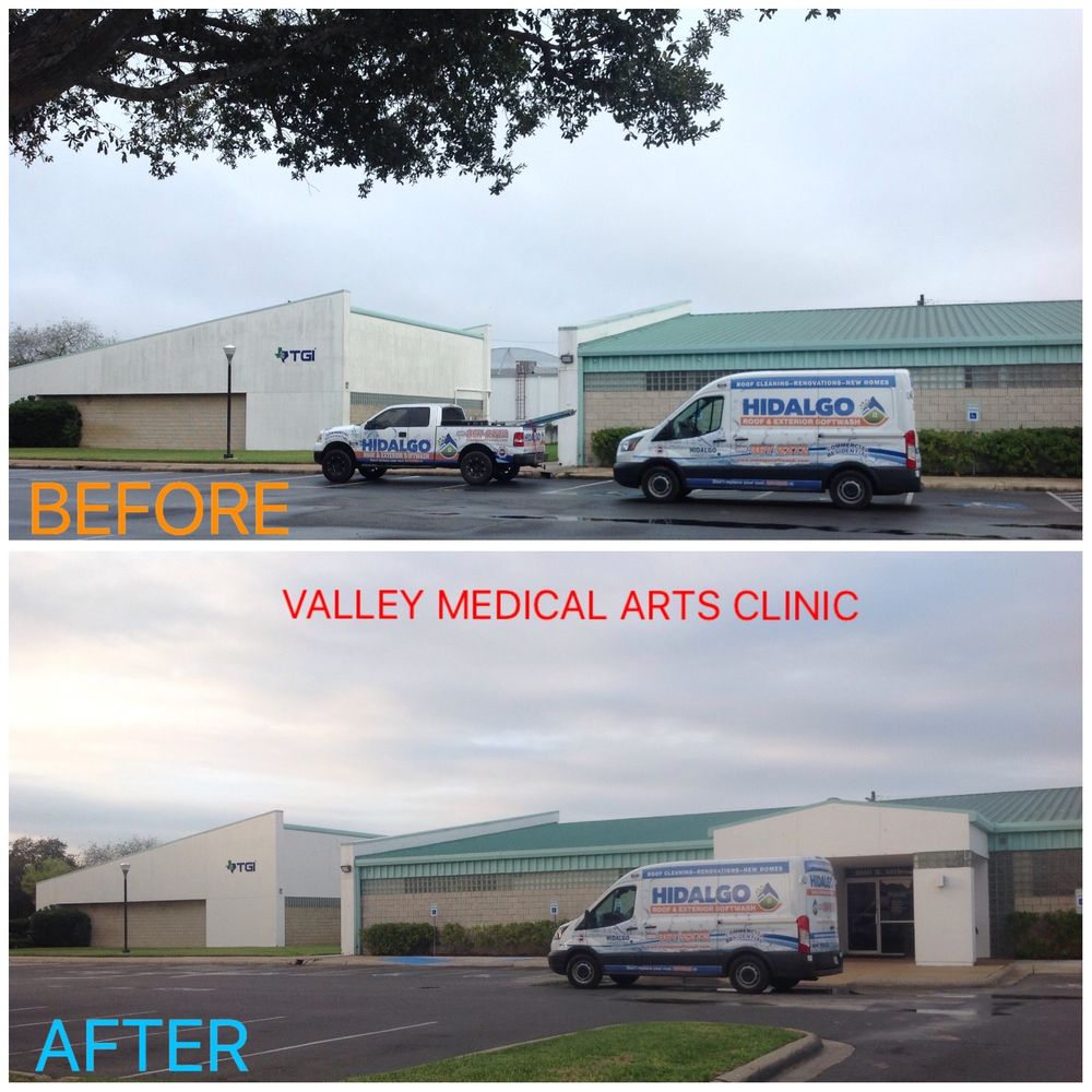 Slide of Hidalgo Roof and Exterior Softwash