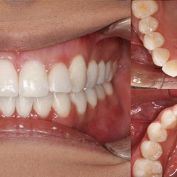 WCI Dental Group