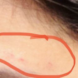 Brow Bliss - That's from last evening..Cuts aren't that visible in the photo but I these are everywhere she threaded on my face.