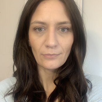 Jay Calvert, MD - 2 months after surgery - Cosmetic Surgeons Near Me - Beverly Hills, California Jay Calvert, MD - 2 months after surgery - Cosmetic Surgeons Near Me - Beverly Hills, California
