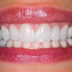 Renew Family Dental - New smile