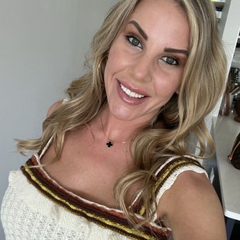 Prime MD Aesthetics + Wellness - 3 days post lip/cheek/nasolabial rejuvenation with Angie - Medical Centers Near Me - Raleigh, North Carolina