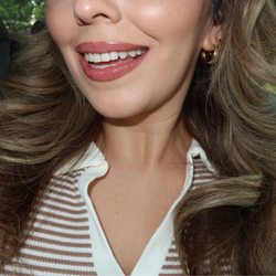 Naturally White Teeth Whitening - Post results