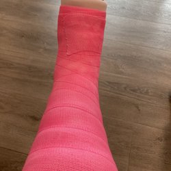 EmergeOrtho-Raleigh - First cast after post-surgery sling.