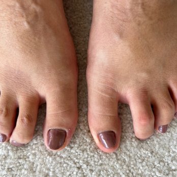 The Nail Fix - That is not normal for my toe nail to be that short(ignore my swollen feet and the increase of my socks and shoes) - Nail Salons Near Me - Ladera Ranch, California The Nail Fix - That is not normal for my toe nail to be that short(ignore my swollen feet and the increase of my socks and shoes) - Nail Salons Near Me - Ladera Ranch, California