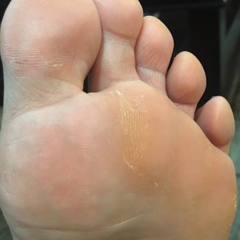 Toi Spa - After the pedicure. Total waste of money - Day Spas Near Me - Davie, Florida Toi Spa - After the pedicure. Total waste of money - Day Spas Near Me - Davie, Florida