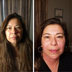 Skin Solutions and More - Microcurrent dramatically reduces facial lines - this after is gorgeous.
