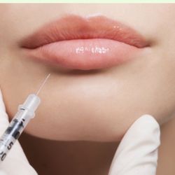 Lips by Dr Wallace