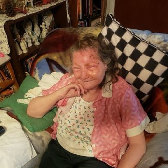 Aspen Dental - Springfield, OR - Patient burned by Aspen - General Dentistry Near Me - Springfield, Oregon Aspen Dental - Springfield, OR - Patient burned by Aspen - General Dentistry Near Me - Springfield, Oregon
