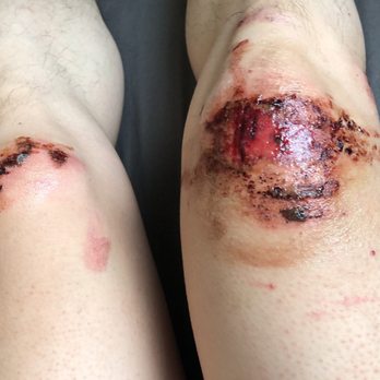Sana Klinikum Lichtenberg - Accident wounds - Hospitals Near Me - Berlin, BE