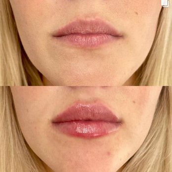 SD Botox - Medical Spas Near Me - Killeen, Texas SD Botox - Medical Spas Near Me - Killeen, Texas