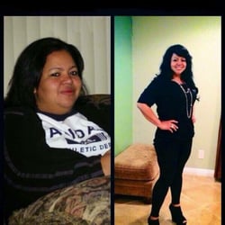 Photo of Skinny Me Med - Van Nuys, CA, US. Wow! So proud of our patient Celia! You go girl!!