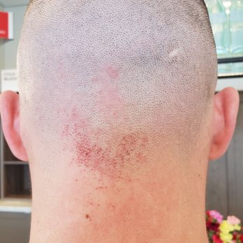 A Barber Shop - How bad the lady butched the back of my neck. - Barbers Near Me - Silverdale, Washington A Barber Shop - How bad the lady butched the back of my neck. - Barbers Near Me - Silverdale, Washington