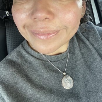 Hi Beautiful Aesthetics - My face before getting any peels or services from Hello Beautiful. - Medical Spas Near Me - Houston, Texas