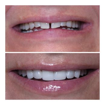 Gables Exceptional Dentistry - Perfectly imperfect smile make over! - Cosmetic Dentists Near Me - Coral Gables, Florida Gables Exceptional Dentistry - Perfectly imperfect smile make over! - Cosmetic Dentists Near Me - Coral Gables, Florida