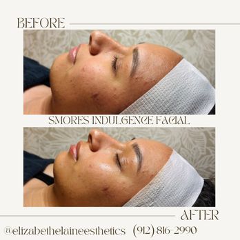 Elizabeth Elaine Esthetics - Smores Indulgence Facial - Skin Care Near Me - Waycross, Georgia Elizabeth Elaine Esthetics - Smores Indulgence Facial - Skin Care Near Me - Waycross, Georgia