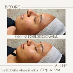 Elizabeth Elaine Esthetics - Smores Indulgence Facial