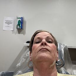 Me after having two teeth extracted!