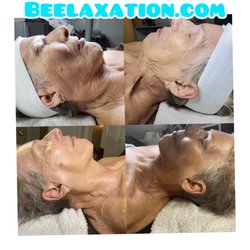 Beelaxation Aesthetics & Natural Healing - Dermaplaning Facial-Bee-luxe facial