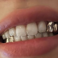 Hella Tooth Gems and Grillz - Custom silver grillz with star and window cutouts