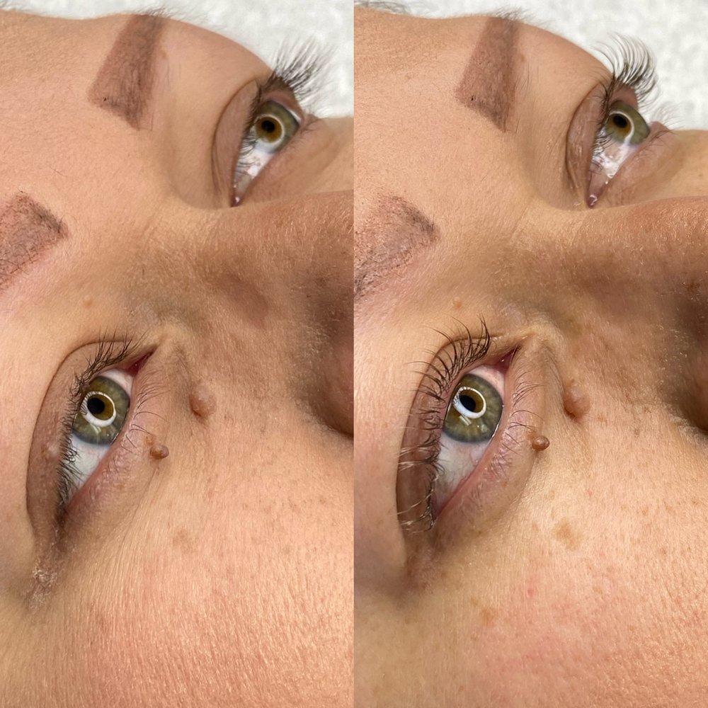 FACEDELIC 11 Photos 920 N Central Ave, Upland, California Skin