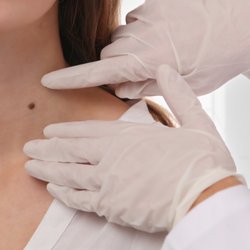 Emmanuel Medical Spa - SKIN TAG REMOVAL