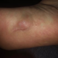 Fullerton Foot and Ankle Specialists